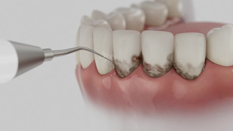 Trusted Root Canal Treatment service in Old Mystic, CT - Dentist Open Now